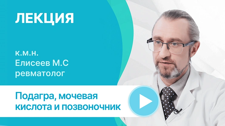 Подагра, мочевая кислота и позвоночник: так странно, так ли редко?
